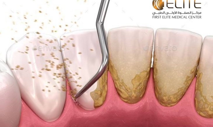 ابتسامة نظيفة تبدأ بعادة بسيطة