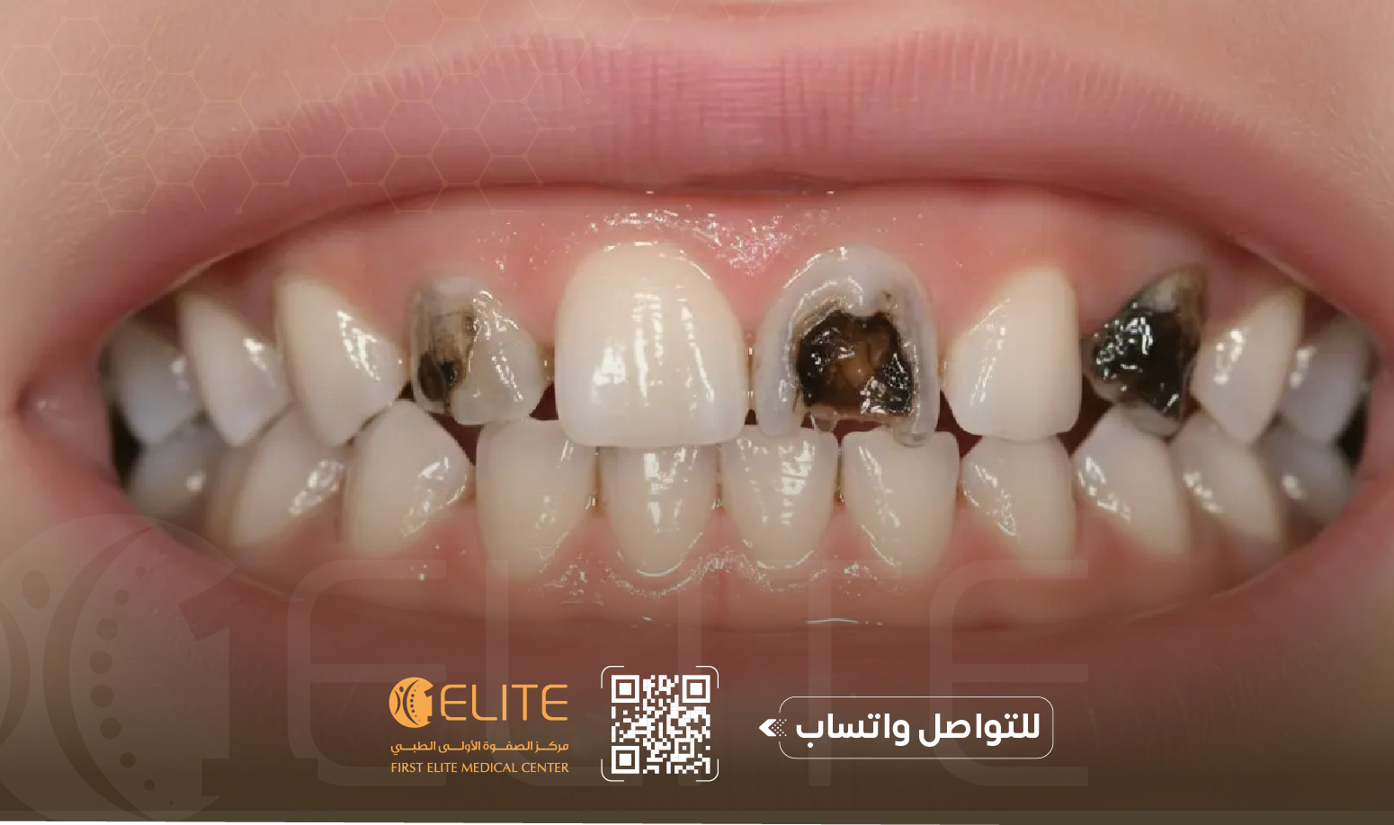أفضل دكتور أسنان في الإمارات